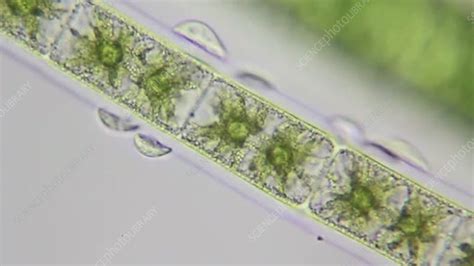  フィルムス（Filamentous Ciliate）: 謎めいた糸状の生き物、水中の隠れた宝石！